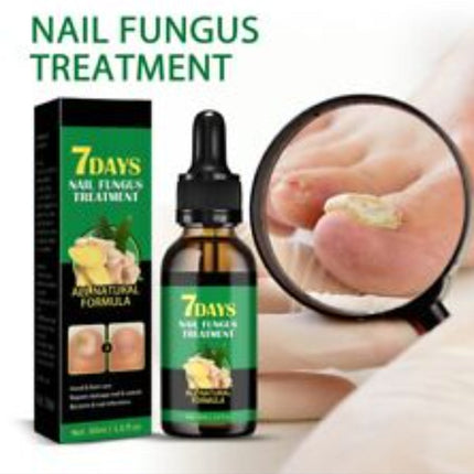 Nail Fungus Treatment Hand Foot Care Repair Gel