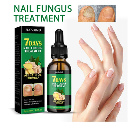 Nail Fungus Treatment Hand Foot Care Repair Gel