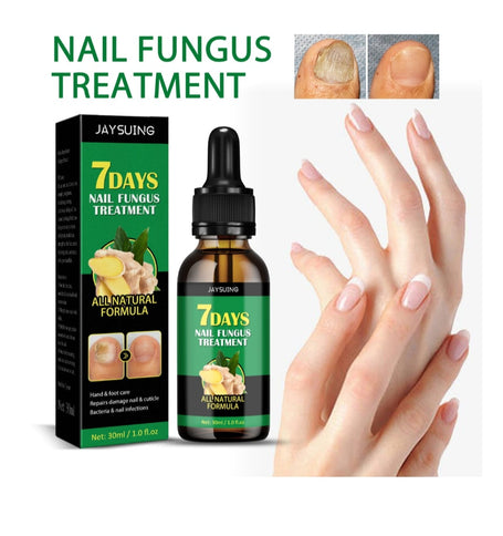 Nail Fungus Treatment Hand Foot Care Repair Gel